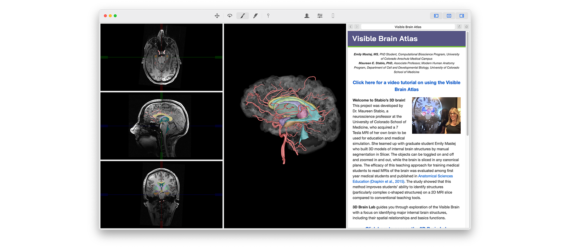 VH Dissector for Medical Education