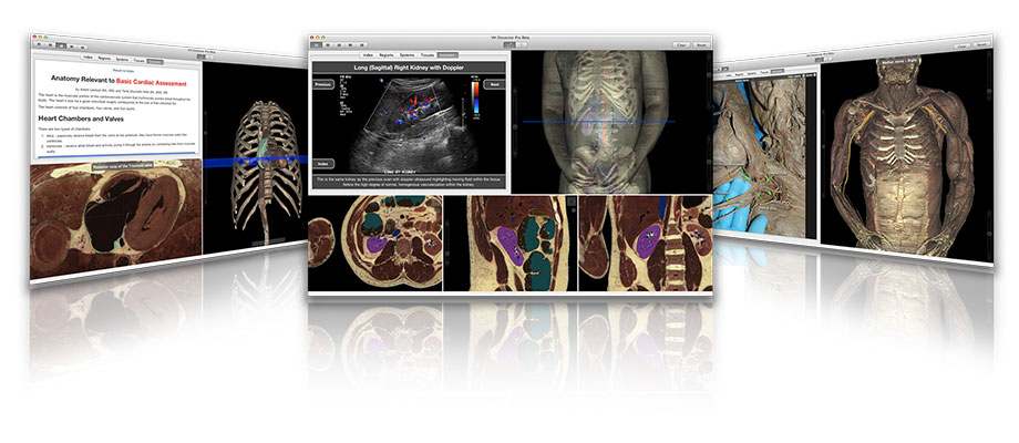VH Dissector Anatomy Software